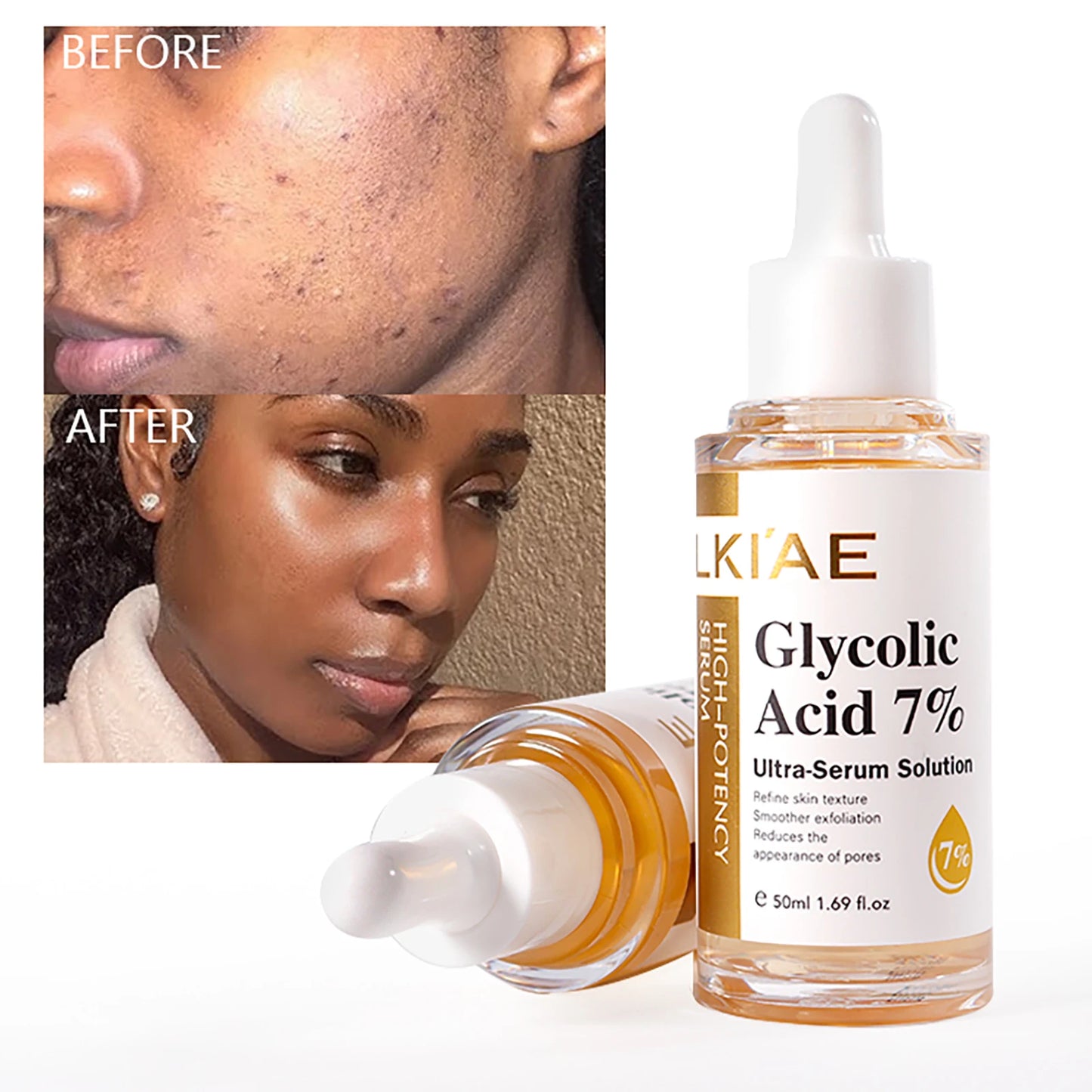 Kit de rajeunissement cutané LKIAE, éclaircissant, hydratant, nettoyant, anti-taches, anti-imperfections, anti-rides, unifiant le teint pour femmes et hommes