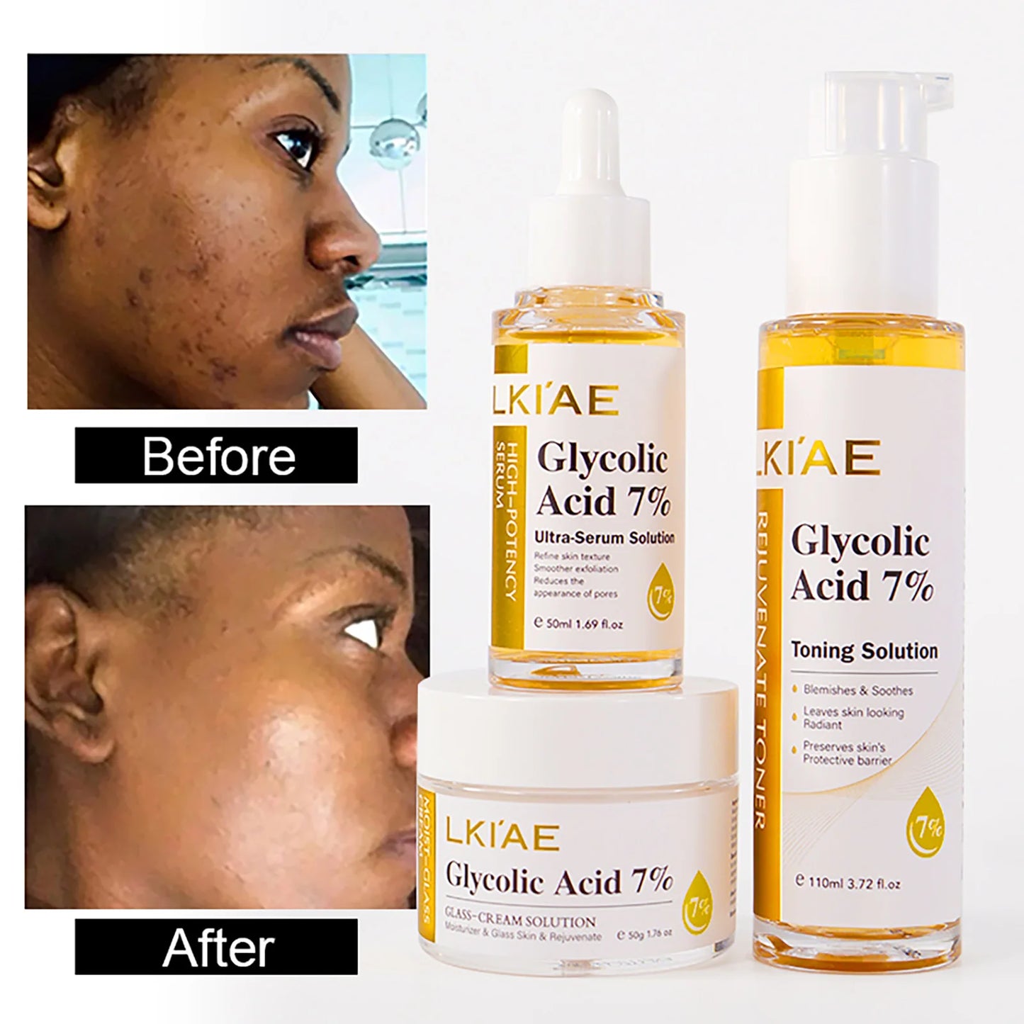 Kit de rajeunissement cutané LKIAE, éclaircissant, hydratant, nettoyant, anti-taches, anti-imperfections, anti-rides, unifiant le teint pour femmes et hommes