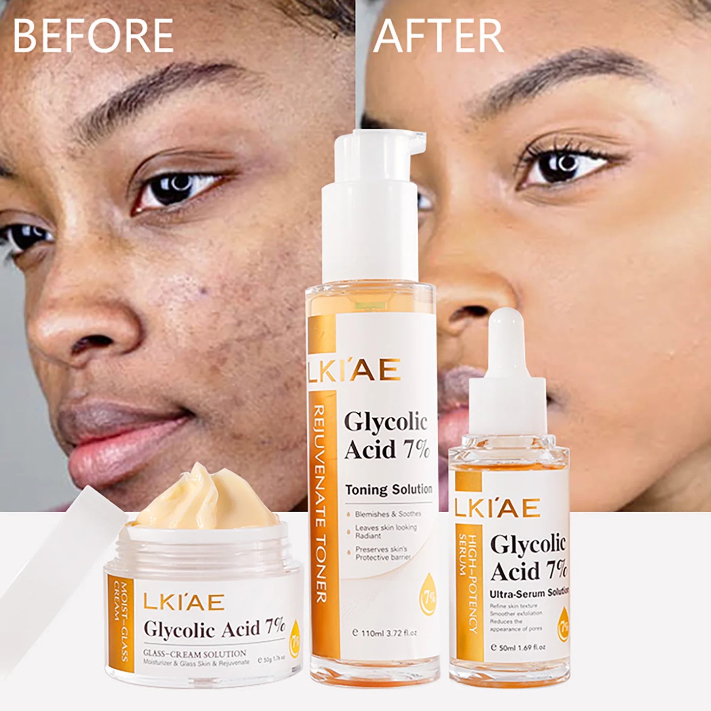 Kit de rajeunissement cutané LKIAE, éclaircissant, hydratant, nettoyant, anti-taches, anti-imperfections, anti-rides, unifiant le teint pour femmes et hommes